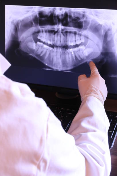 Best Broken Tooth Emergency  in Hebbronville, TX