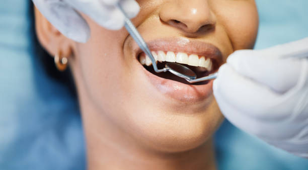 Reliable TX Emergency Dentist Solutions